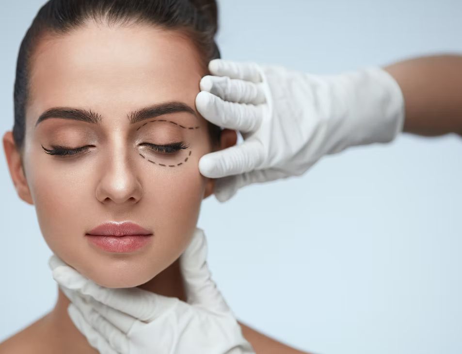 Blephroplasty