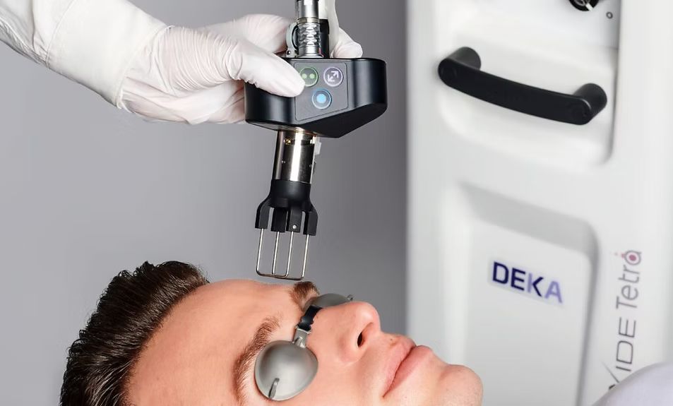 Chemical Peels