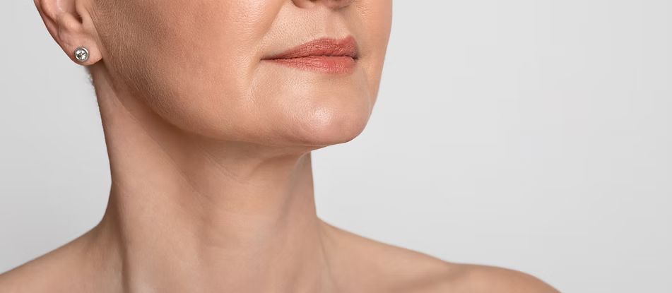 Neck Lift Image