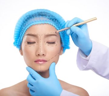 Rhinoplasty blog 360x320