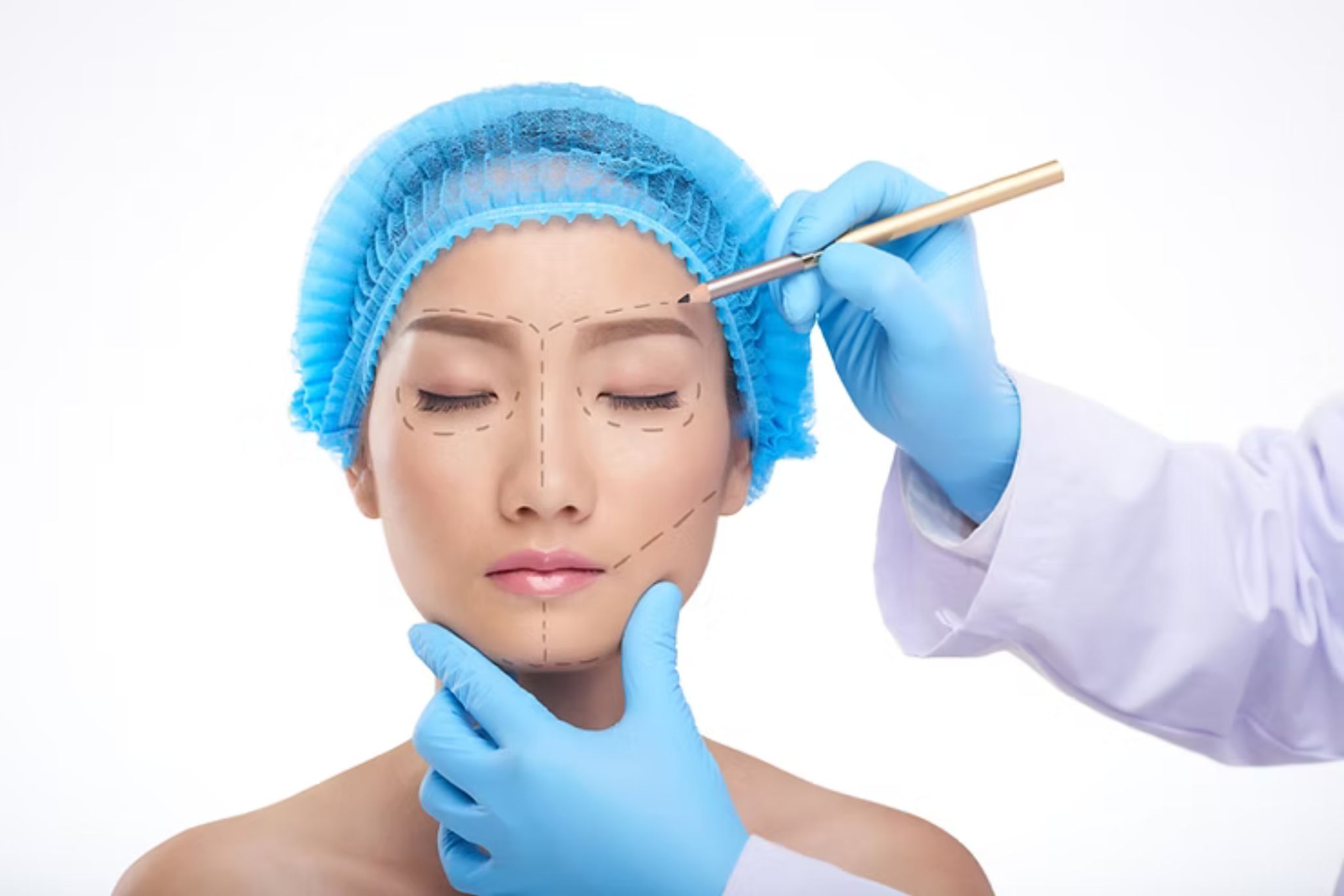 Rhinoplasty blog